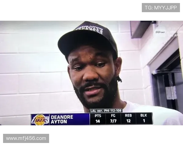 艾顿眼伤晒照雷迪克笑称酷似海盗